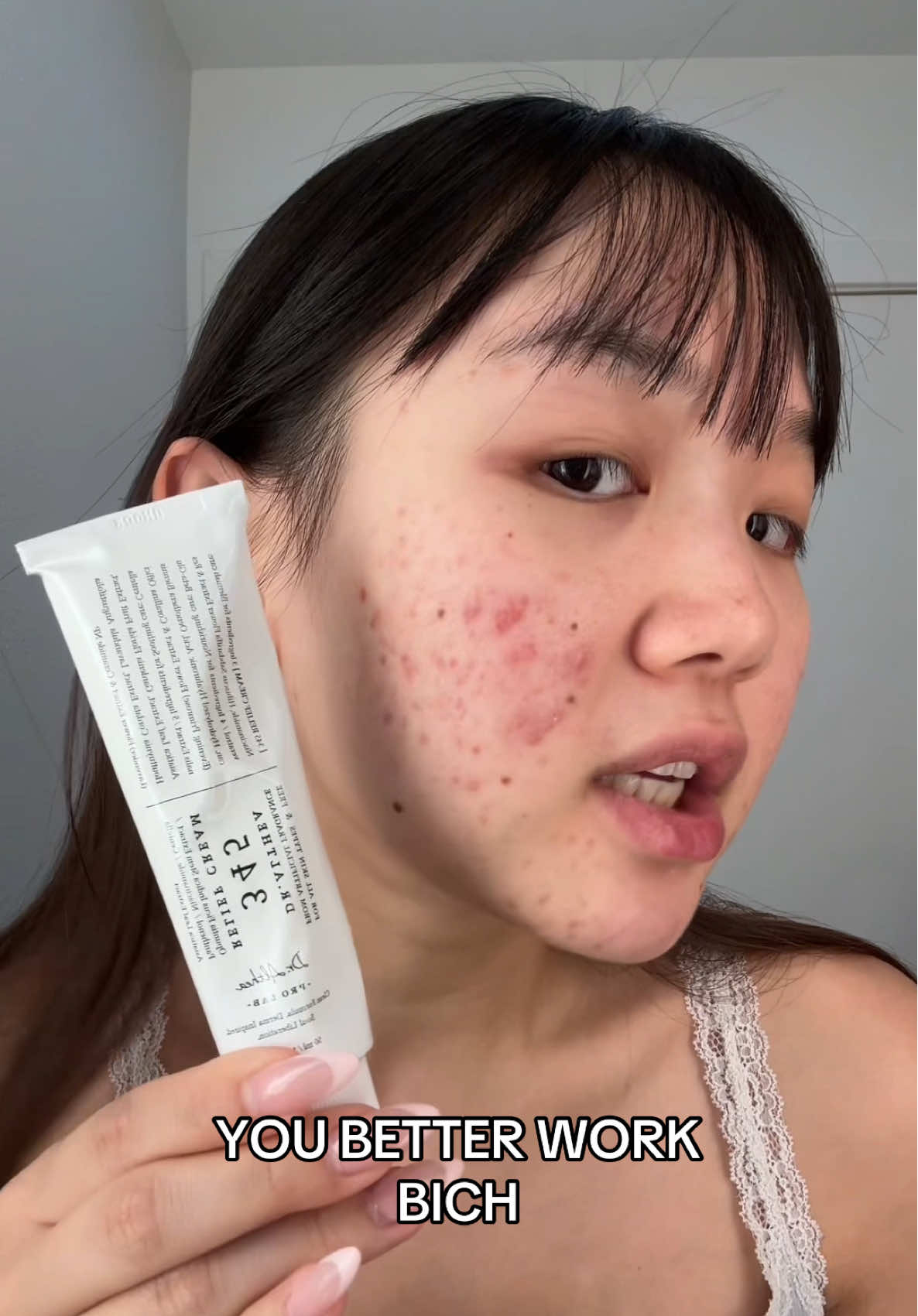 This moisturizer has been so gentle on my sensitive skin 🌿 I can use it every day without any problems!🥰  Yesstyle Code: GRACE888 #acne #skincare #dralthea #345reliefcream #sensitiveskin #acneskincare #kbeauty #yesstyle #acneproneskin @dr.althea_official  Ib: @mikibenavente 