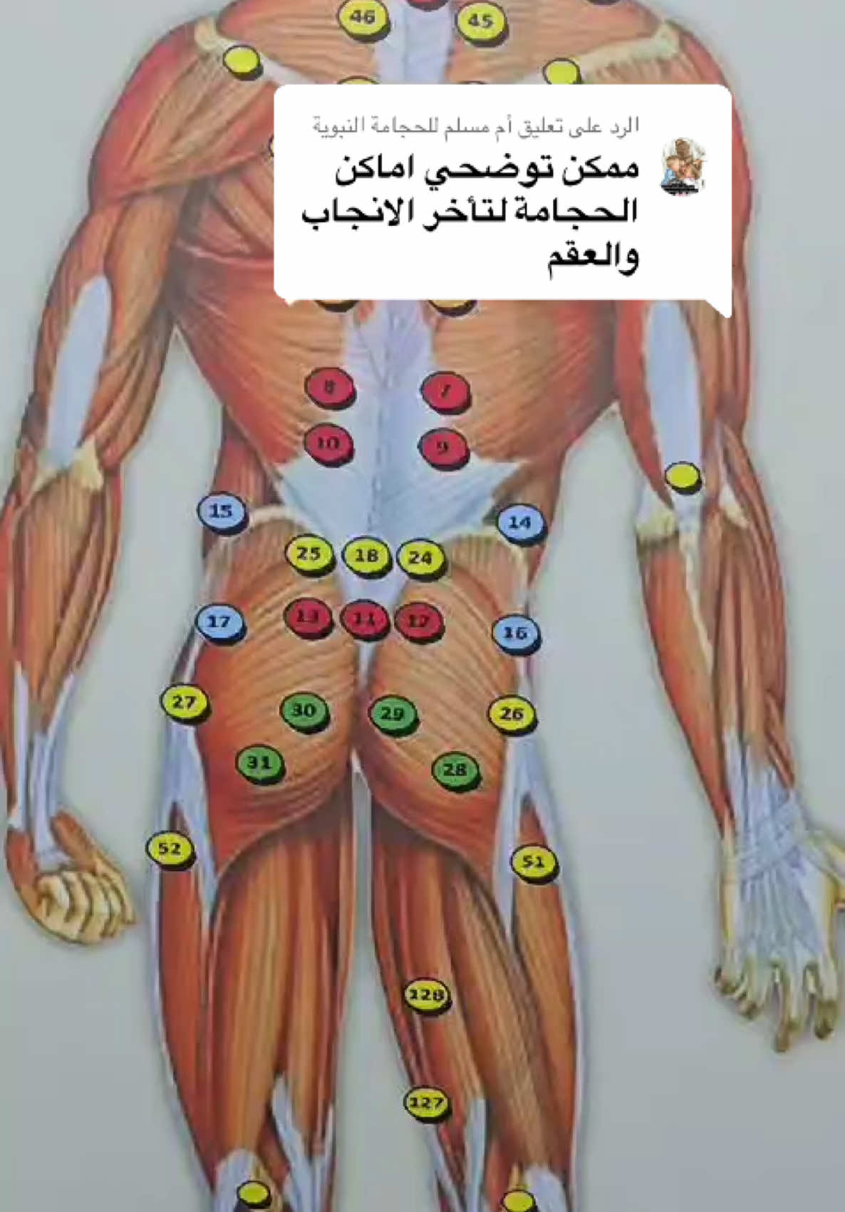 الرد على @أم مسلم للحجامة النبوية اماكن حجامة الحمل لتأخر الإنجاب والعقم #حجامة #حجامة_الظهر #الحمل #الانجاب #مراكز_نحو_النجاح_للحجامة #cupping #cuppingtherapy #reels #اكسبلورexplore #saudiarabia #السعودية #fypシ #تأخر_الحمل #tiktokviral #الرياض  @CUPPING_CLINIC  @CUPPING_CLINIC  @CUPPING_CLINIC 