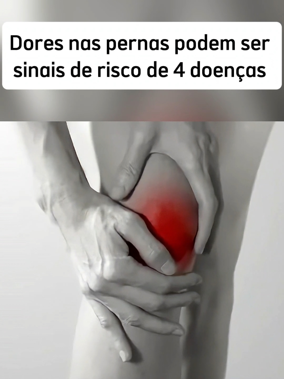 dores nas pernas pode ser um alerta  #doresnaspernas #varizes #dor  #varizessemcirurgia #saude #fibriomialgia #trombose #Saude #herniadedisco #dornaspernas 