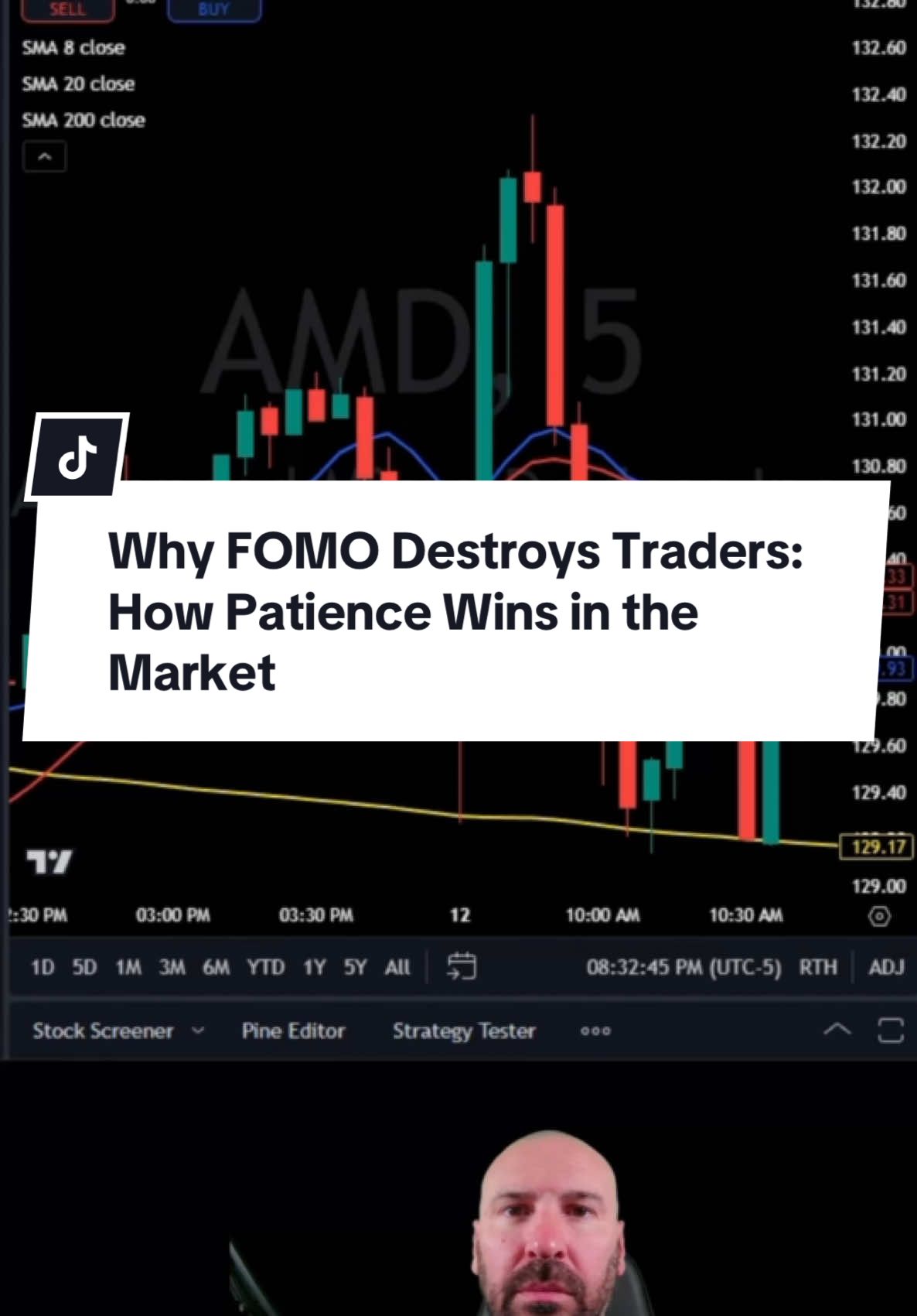 Why FOMO Destroys Traders: How Patience Wins in the Market #stocks #trading #stockmarket 