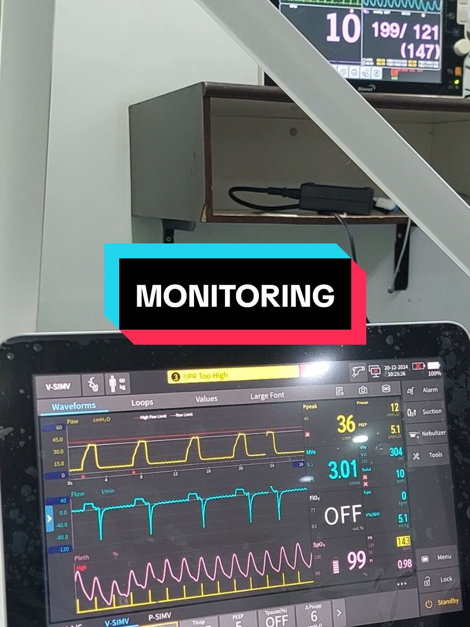 monitoring pasien...  #fypシ  #sad  #rindurumah 