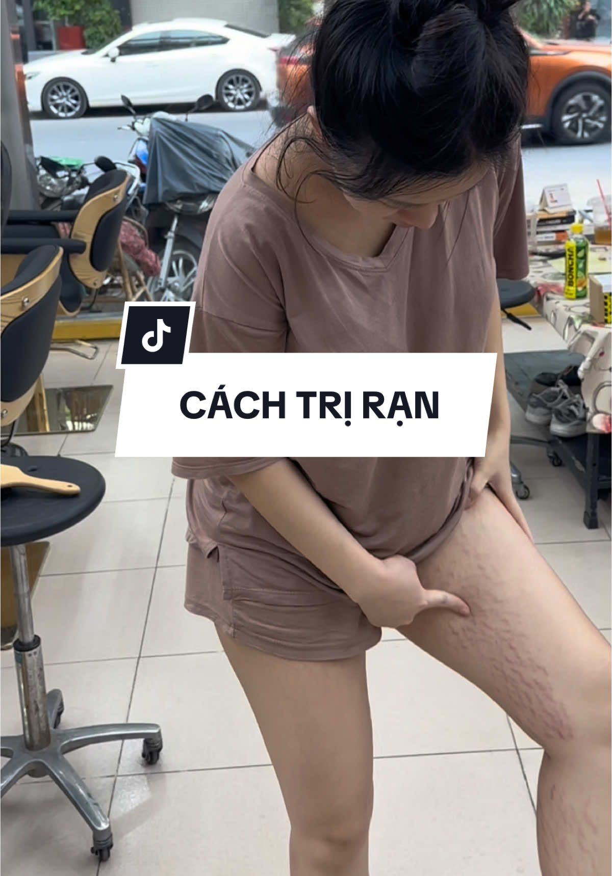 Clip được các mẹ hỏi nhiều cách trị rạn quá. Nay e làm hẳn 1 cái clip quá trình mờ rạn của em tới hiện tại #tiktok #review #kemran #duongthithuphuong 