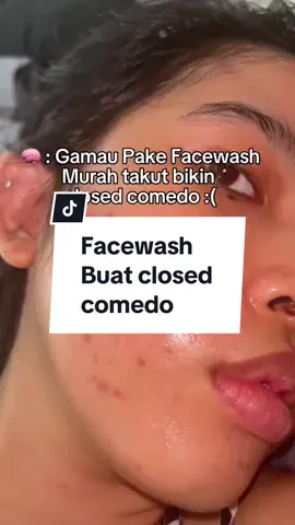 Gamau ekspetasi tinggi sm facewash murahan ini tp w ganyangka sm hasilnya @Acnaway Official #jerawatan #acneprone #acnefigther #acnebestie #acneway 