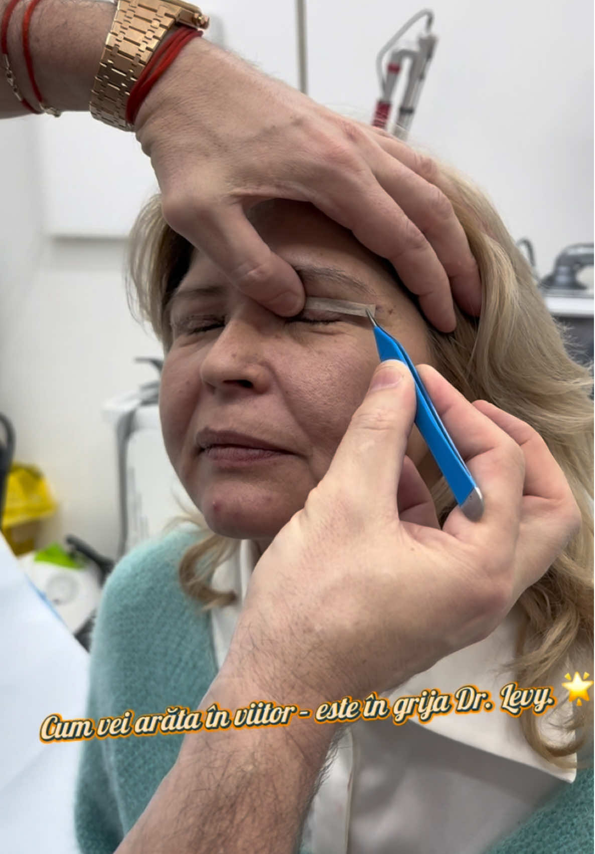 Cum vei arata in viitor- este in grija Dr. Levy🙌🏼👉🏻 #blefaroplastie #bucurestiromania🇷🇴 #transformation #plasticsurgeonsoftiktok #drlevymedicalcenter #blefaroplastia #blefa #plasticsurgery 