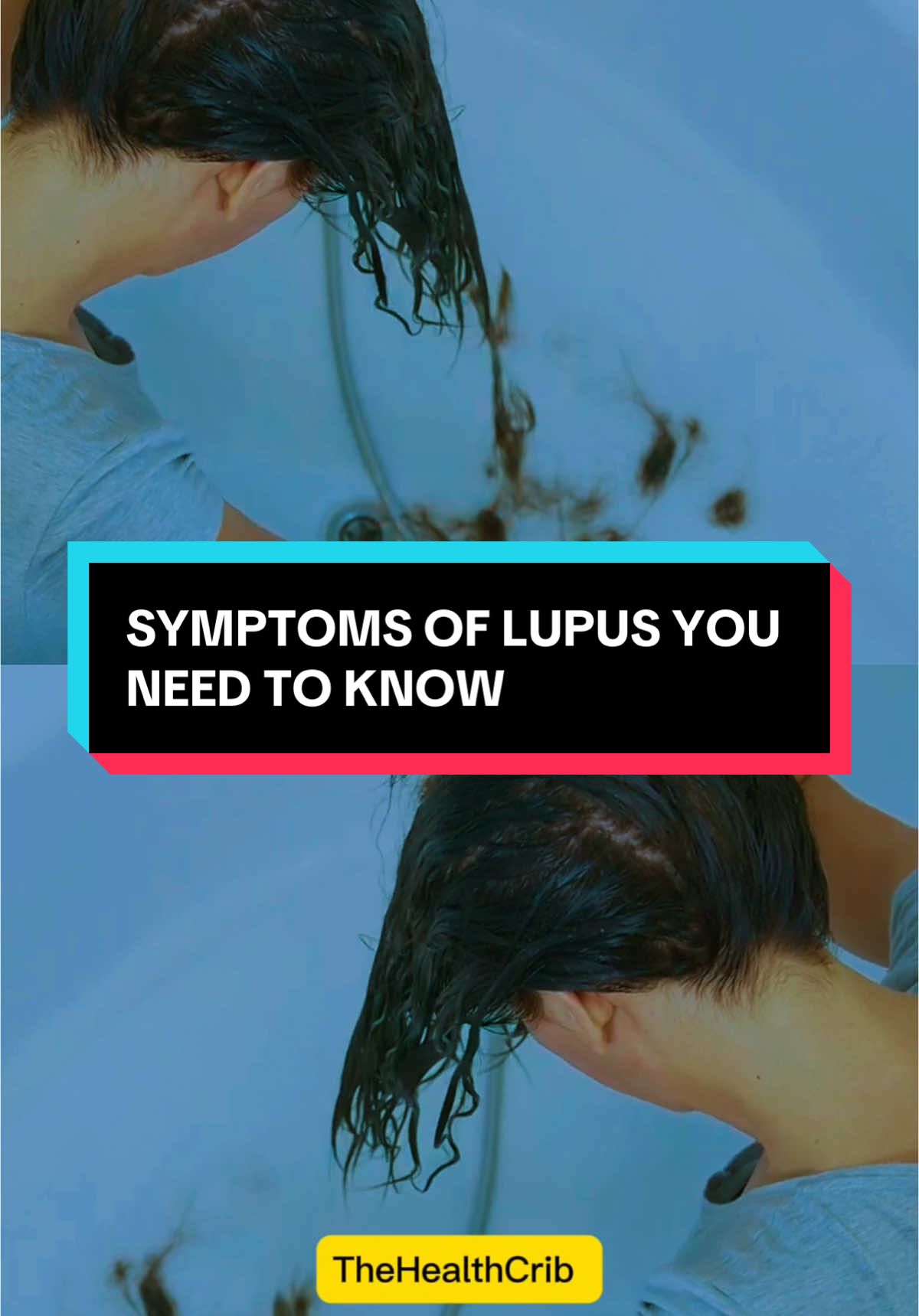 SYMPTOMS OF LUPUS YOU NEED TO KNOW#lupusawareness#lupus#lupusstruggles#lupuswarrior 