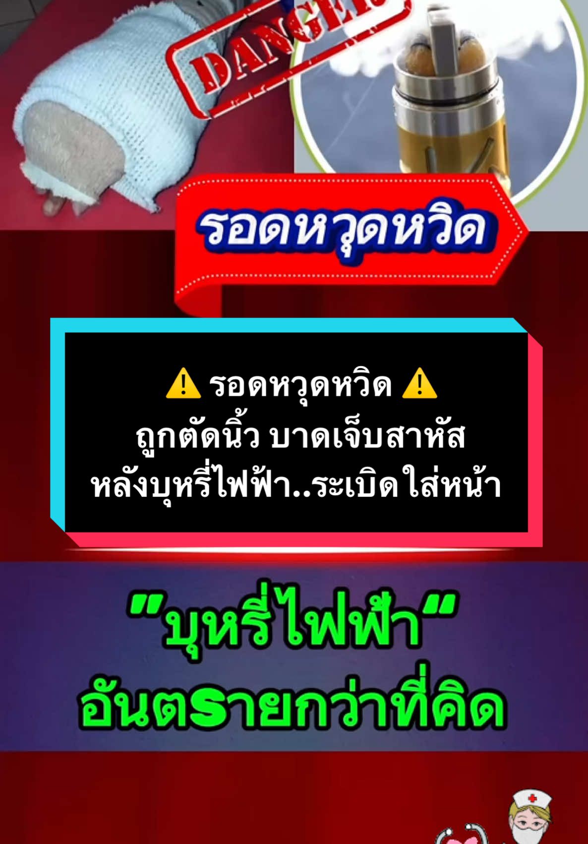 ถูกตัดนิ้ว บาดเจ็บสาหัส หลังบุหรี่ไฟฟ้า..ระเบิดใส่หน้า #มะเร็ง #มะเร็งตัวร้าย #เซซามิน #งาดํา #รักสุขภาพ #นีพยาบาล  @นีพยาบาล รักสุขภาพ  @นีพยาบาล รักสุขภาพ 