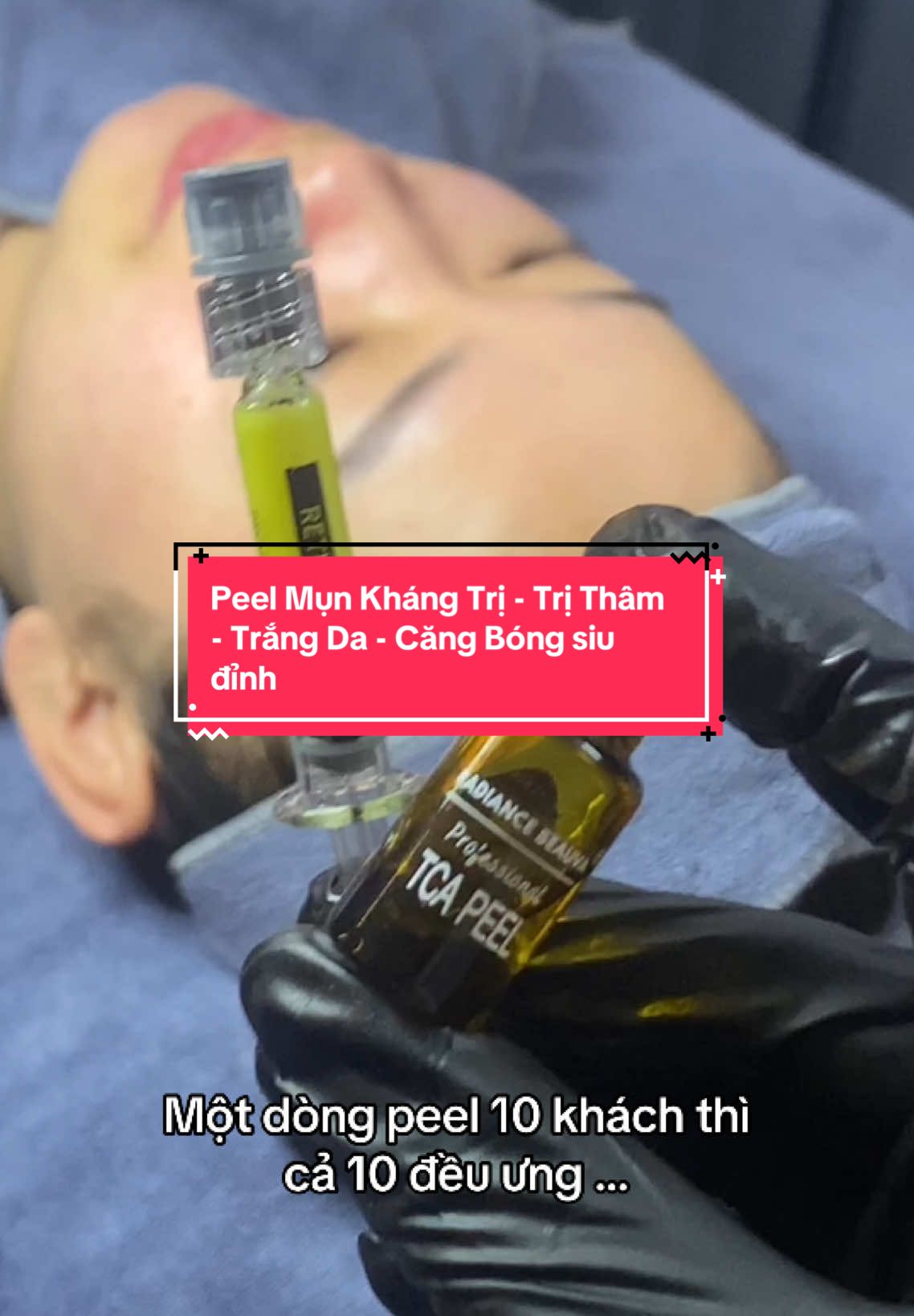 Dòng peel hothit hiện nay 10 khách cả 10 đều ưng …#daotaohocvienchuyennghiep #daotaohocvien #peelda #trăngda #trimun #tritham #peel #dmp #duocmypham 