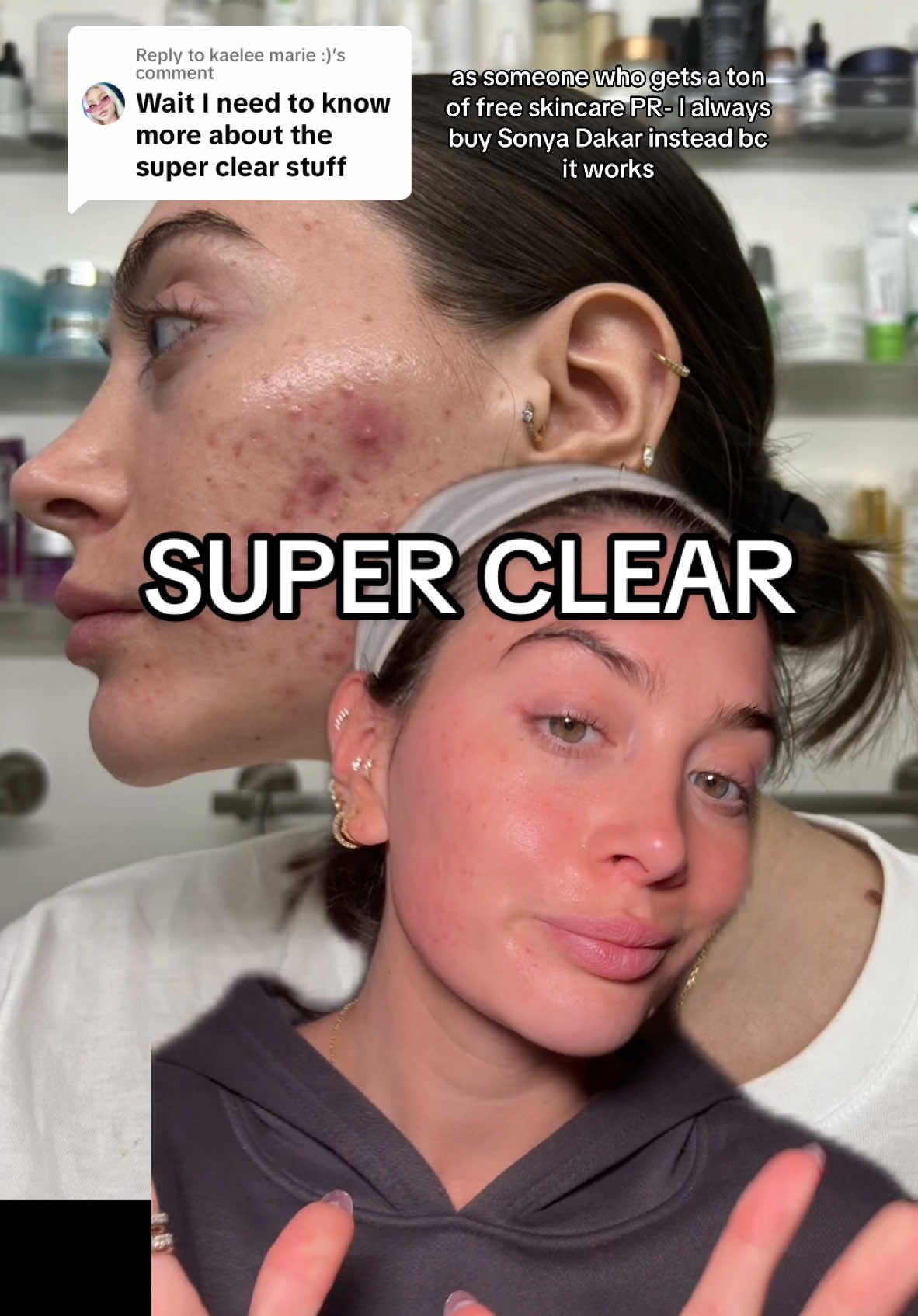 Replying to @kaelee marie :) #greenscreen i do not get gifted her products so yes i buy with my own $$$$ and yes its worth every penny #sonyadakar #superclear #skincare @Sonya Dakar Skin Care 