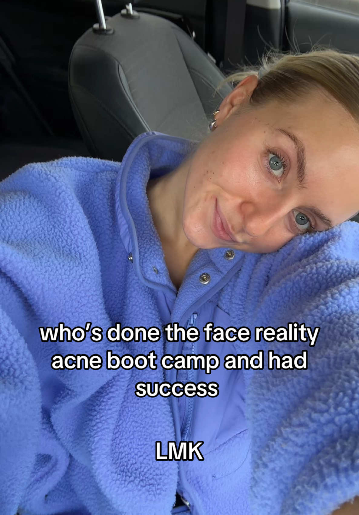 starting tomorrow im desperate & have tried everything xxxxx #facereality #acne #facerealityskincare #acnebootcamp 