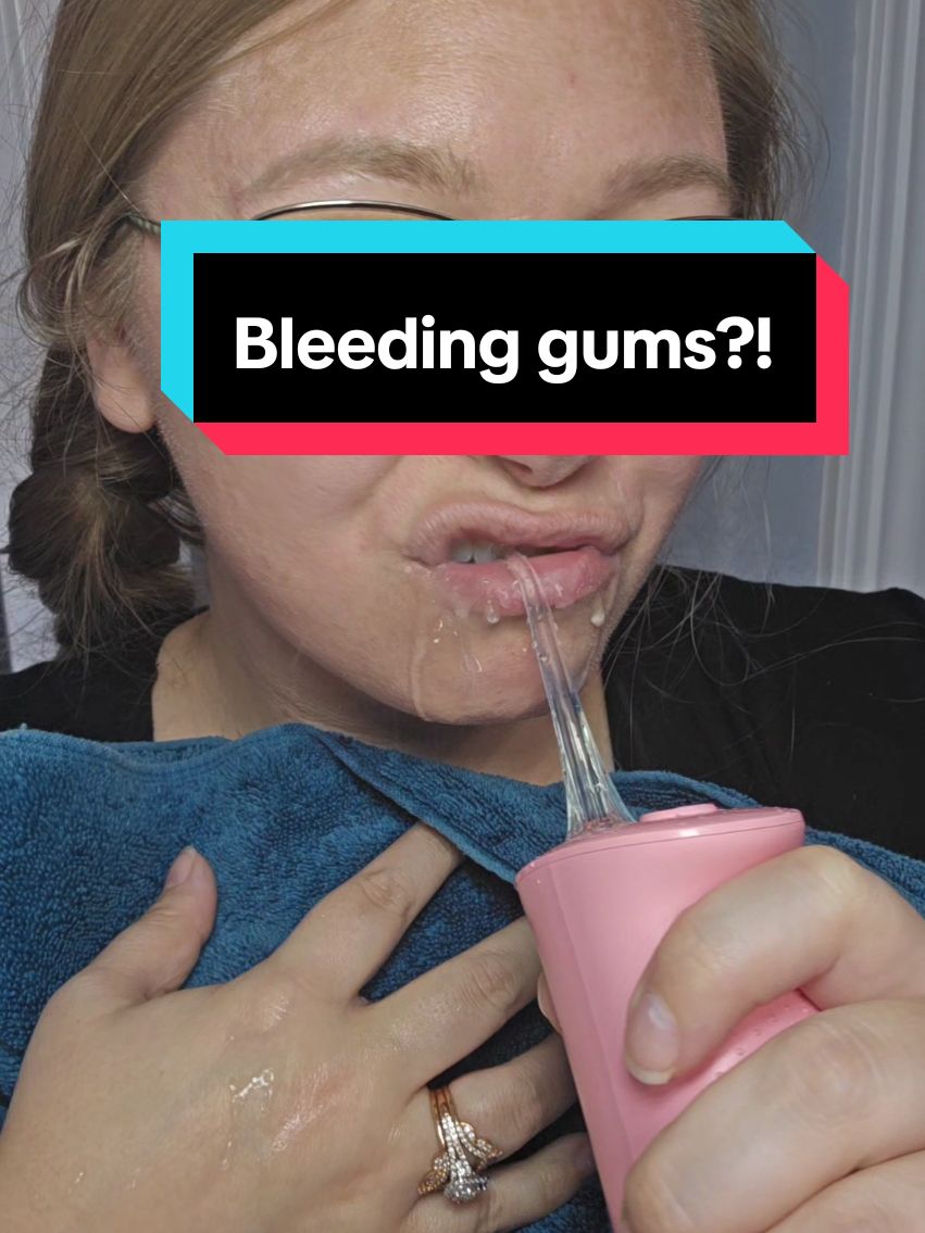 did you know that bleeding gums is a sign that you need to be flossing more? I'm not a medical professional but a quick Google search, or a trip to your dentist, will tell you that it's gingivitis. Fight back against gingivitis with this Bitvae Water Flosser, I've linked it for you!  #gingivitis  #oralhealth  #wellnesstips  #happysmile  #waterflosser  #floss  @Bitvae Oral Care 