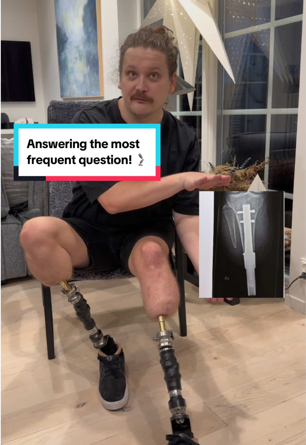 I get this question so often, figured I’d make a video! 🦿 Do you have any other questions for me? 🔥 #fyp #faq #askmeanything #prosthetic #amputee 