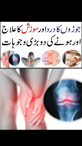 جوڑوں کا درد اور سوزش کا علاج اور ہونے کی دو بڑی وجوہات Joro Ka Dard or Sozish ka ilaj | Stiffness and Joint Pain Treatment#foryoupage 