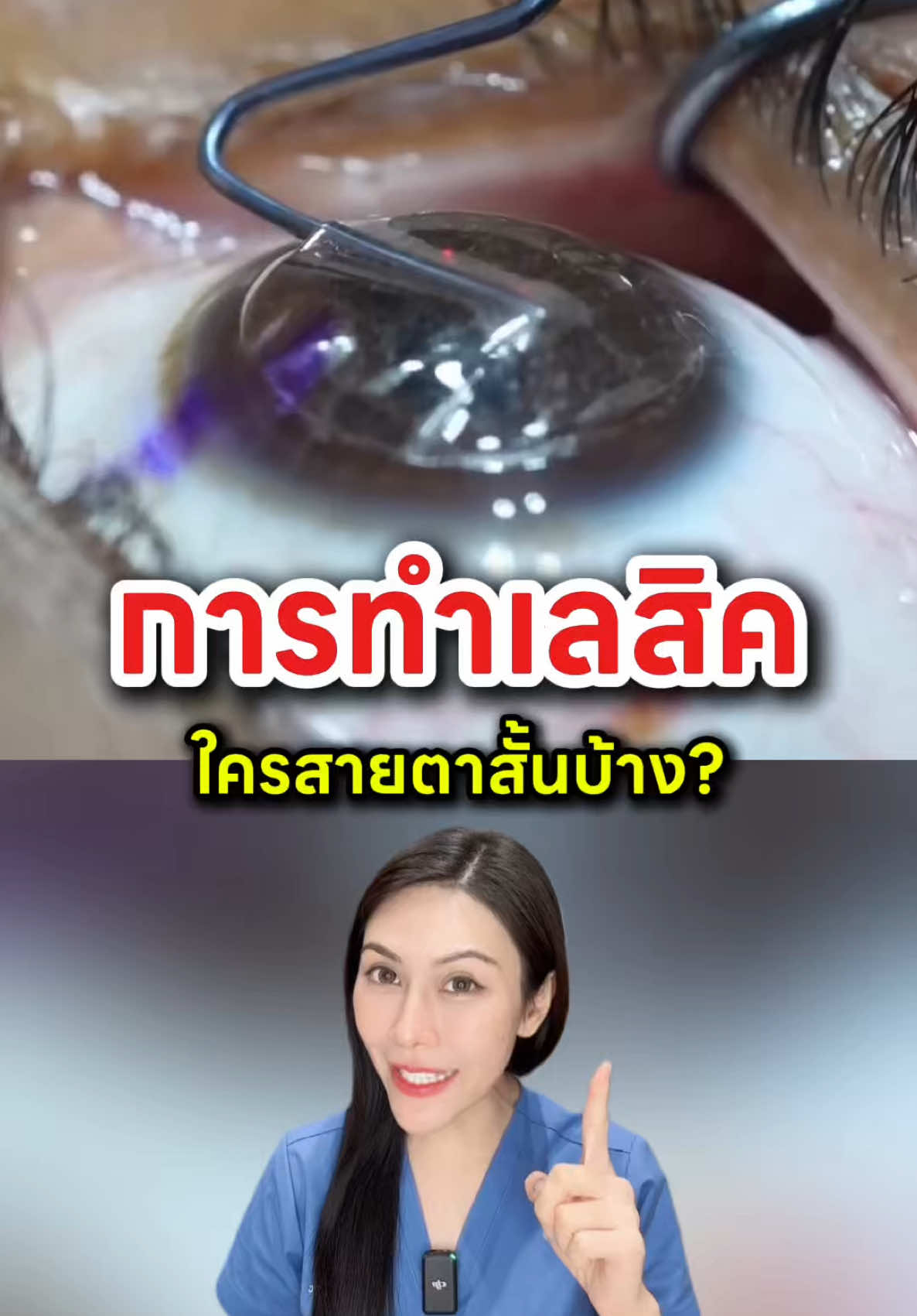 การทำเลสิค #สายตาสั้น #สายตายาว #สายตาเอียง #การมองเห็น #Lasik #TikTokUni #รักสุขภาพ #พยาบาลอัญ #Aunnyc #ที่สุดแห่งปี #ปีใหม่2025 