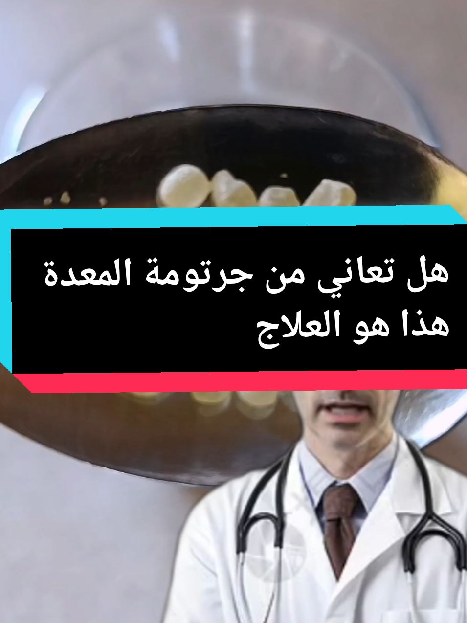 #هل تعاني من جرتومة المعدة هذا هو العلاج #علاج_طبيعي #علاج_جرتومة_المعدة #جرتومة_المعدة #وصفة_سهلة #وصفات_طبيعية #tiktok_india #foruyou #fyp 