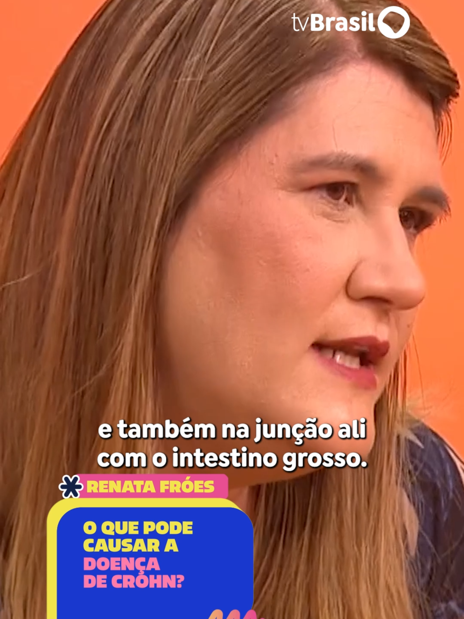 A presidente da Associação de Gastroenterologia, Renata Fróes, fala no #SemCensura sobre a Doença de Crohn, que afeta milhares de pessoas no Brasil e que pode afetar qualquer parte do trato digestivo. Confira! Assista aqui ao programa completo no canal da TV Brasil no YouTube, no Spotify e no app TV Brasil Play. Link na bio!