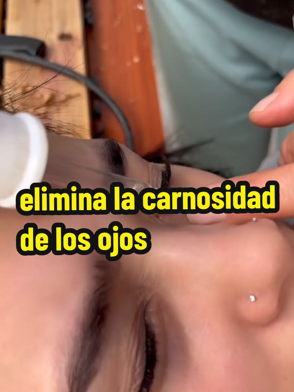 elimina la catarata y la carnosidad de los ojos con el agua de coco #remedioscaseros #catarata #carnosidadenelojo #ojos #vista #coco 