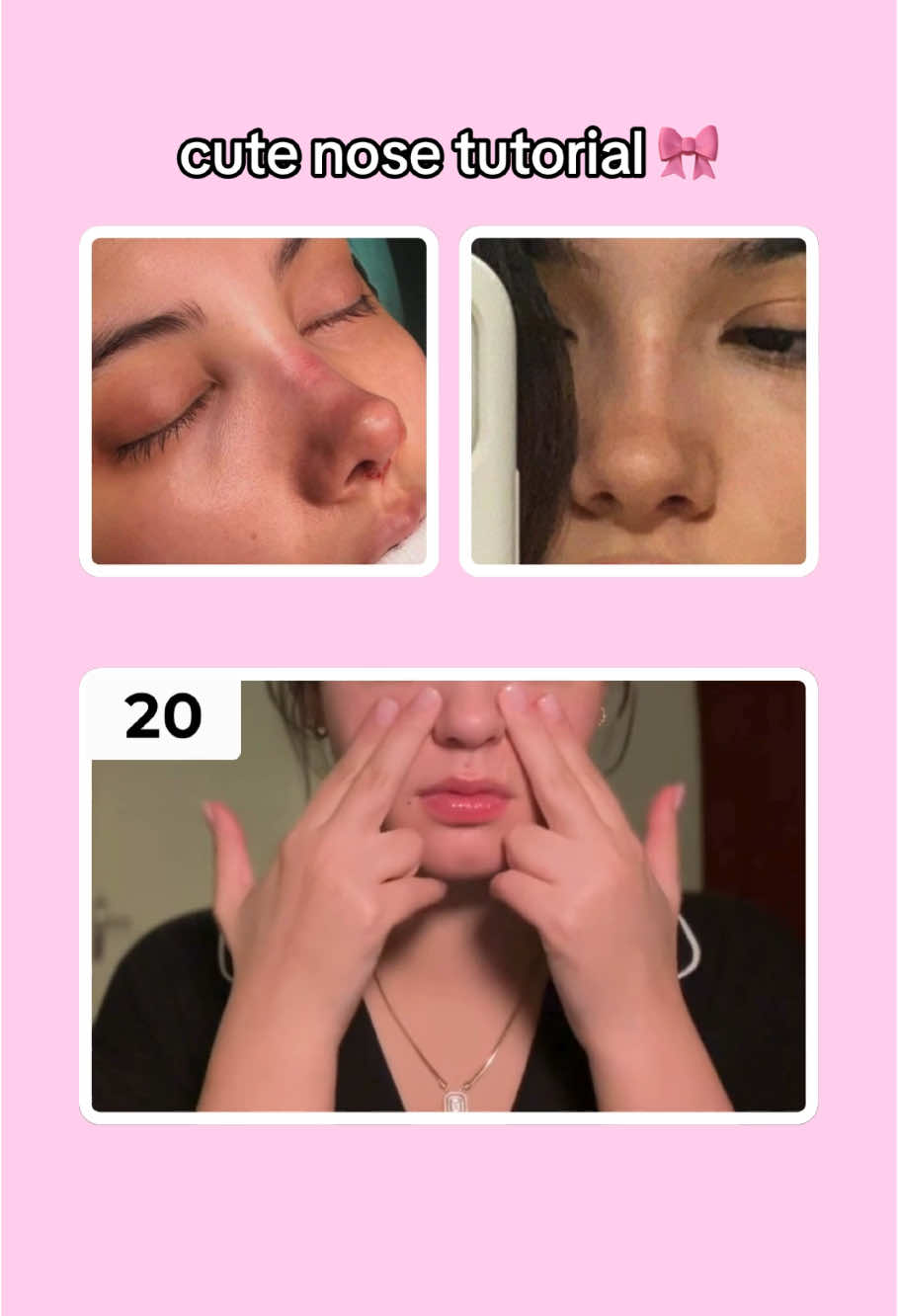 cute nose tutorial 🎀 more videos on my Youtube channel, link in bio 💛 #exercise #GlowUp #viral #foryoupagе #workout #tutorial #girltips #fürdich #fy #fyp #foryou #furdich #nose #nosetutorial #nosejobcheck #nosecontour #noseexercise 