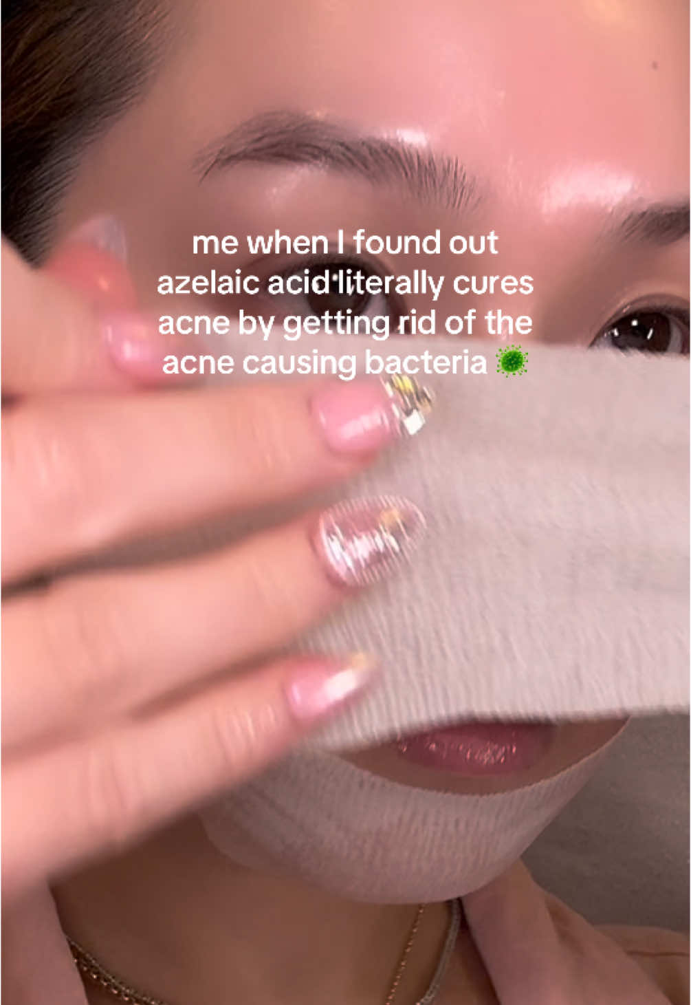 I was today years old when I found out the GOLD that is azelaic acid 😱💚☺️ #azelacicacid #koreanbeauty #kbeauty #skincare #glassskin #acne #skincareroutine 