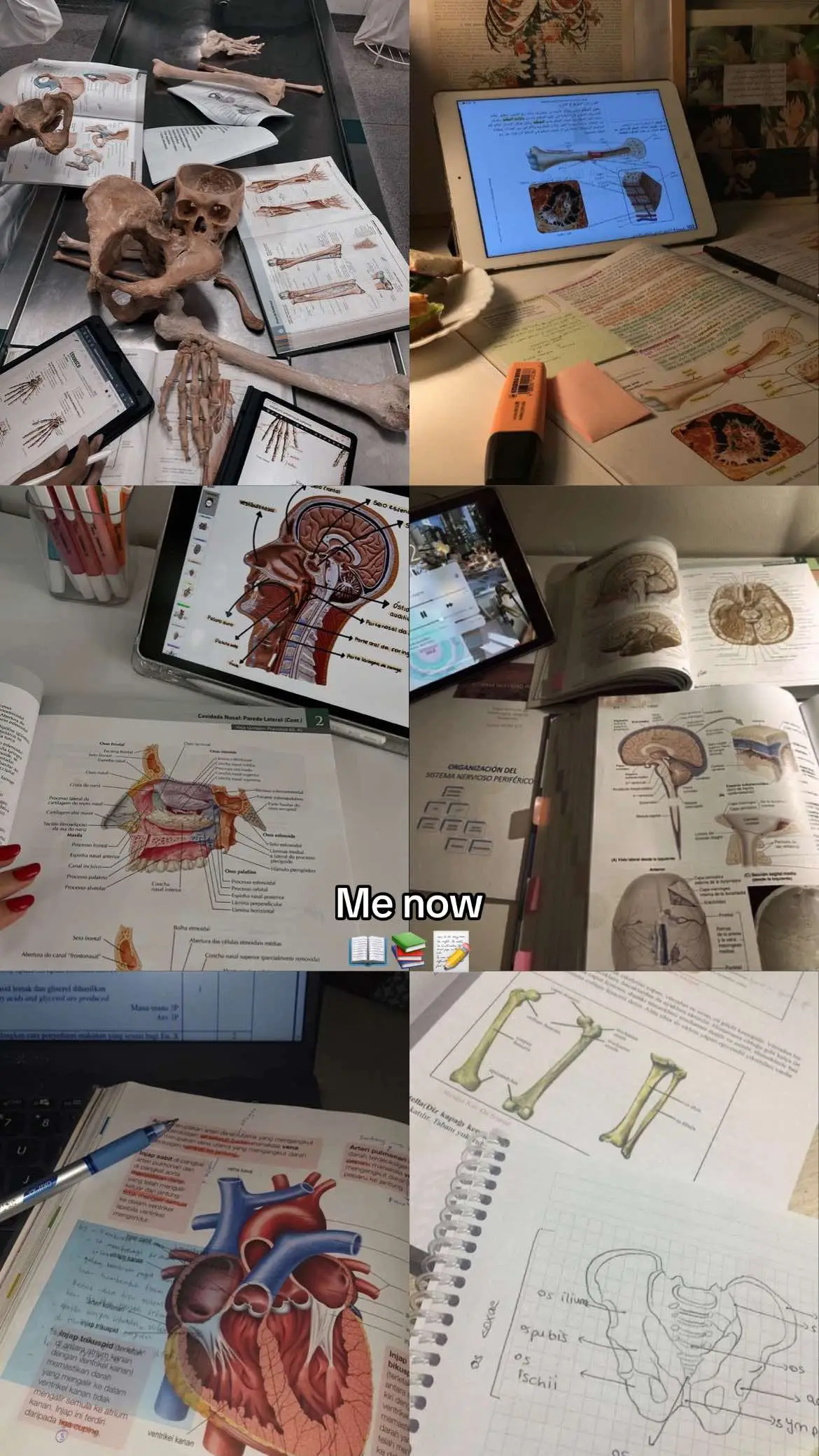 #علاج_طبيعي #physiotherapy #university_of_tripoli #study 