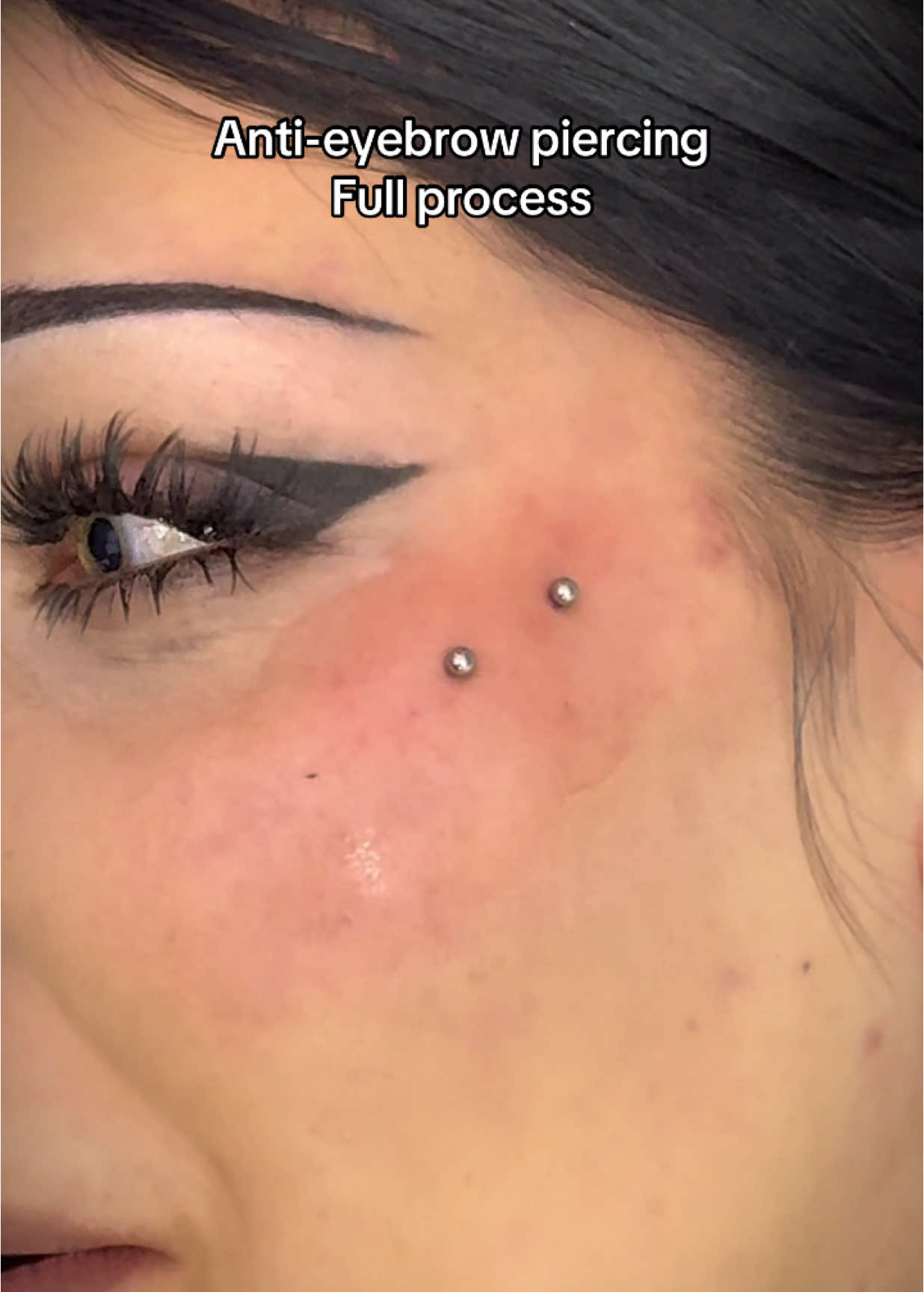 Anti-eyebrow piercing by @Amy  It’s not a Piercing unless it’s Underground! BOOK NOW! Link in bio! Walk-ins available 📍Watford ⠀ #antieyebrow #antieyebrowpiercing #piercing #surfacepiercing #piercingideas #londonpiercer #londonpiercing #piercer #piercings #enfieldtown #pierced #fyp #viral #piercingaddict