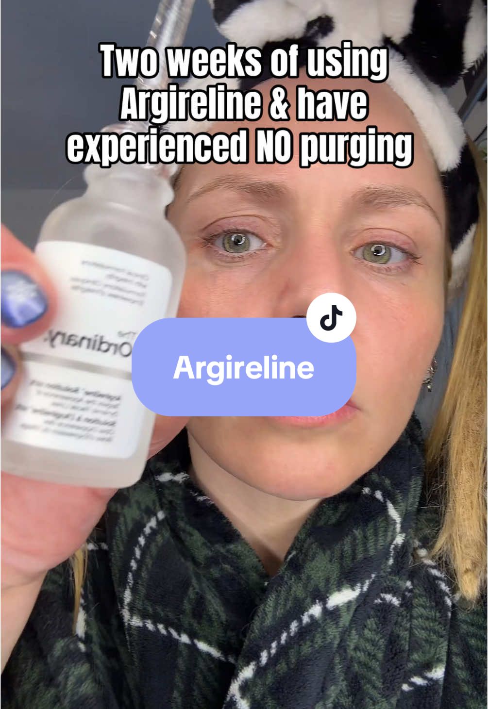 Im in it for the long haul & cant wait to see the results! @The Ordinary #botoxinabottle #argireline #argirelinepeptide #argirelinesolution #antiagingserum #antiagingskincare #antiaging #skincare #afforadableskincare #antiagingskincare 