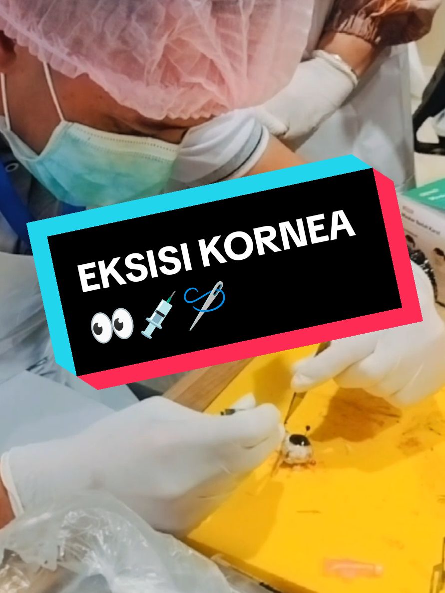 ミ★ 𝘗𝘌𝘙𝘈𝘞𝘈𝘛 𝘔𝘈𝘛𝘈👀 ★彡 #capcut_edit #perawatmata #trendingvideo #foryou #masukberanda #fypシ゚ #keperawatan💊💉 #nursing #wetlab #eksisikornea  #bankmataindonesia #bmi  #lebj #lionseyebankjakarta  #eyecenter #jakartaeyecenter #celebeseyescenter #jechospitalsandclinics #jecorbitamakassar @jeceyehospital @centralohiolionseyebank 