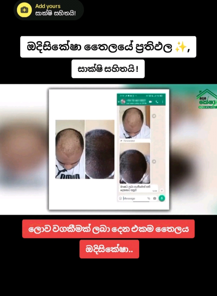 හිසකෙස් වර්ධනය සඳහා ලොව වගකීමක් ලබා දෙන එකම විශ්මිත තෛලය 