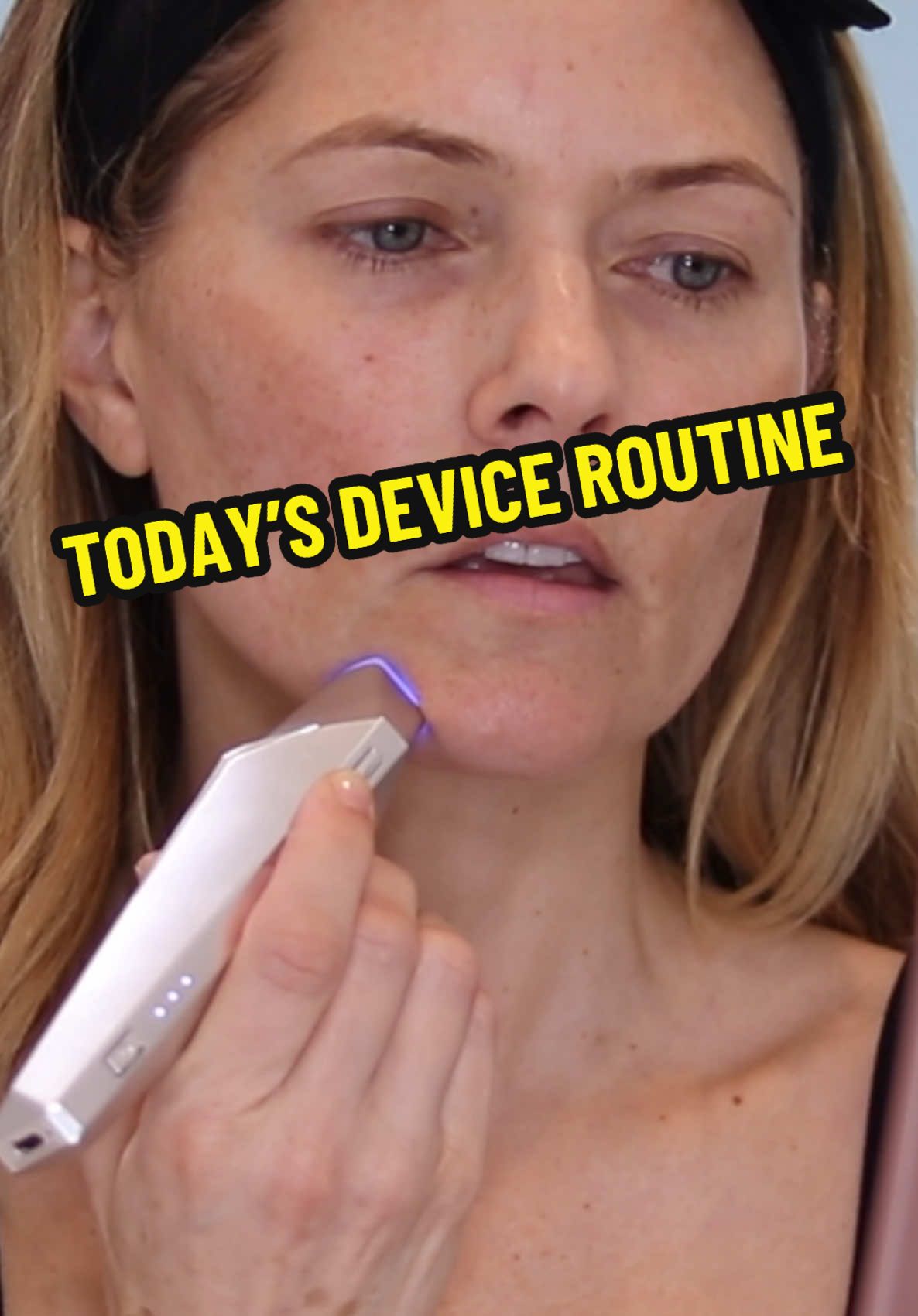 A top FAQ I get is what is my daily beauty device routine. The answer: I don’t have one. Some days, I am really busy and I only have time to use a couple of devices - and most devices are not to be used every day anyway. Since I have been using my devices for many years now, I have shifted into an intuitive mode and only use the devices I need to for that specific day. The only caveat is if I’m on a strict schedule while testing out a new device for an upcoming YouTube video and I need to take before/after photos and track my progress. But I can confidently say that I do use at least one device every single day! It’s a lot of work to maintain results and keep going with an injectable-free face, but I’m here for it!  Devices in this video: @NIRA Skin Precision laser (2 minutes) and @TriPollar Envig Edge radio frequency device (4 minutes). I love this routine when I’m in a hurry because it’s so fast and requires NO GEL, and I move on to my skincare routine directly afterwards and I’m out the door!  #beautybeyond40 #beautydevice #skincareroutine #over40 #over50 #niralaser #envigedge #tripollar #hoodedeyes #darkcircles #skintightening #jowls 