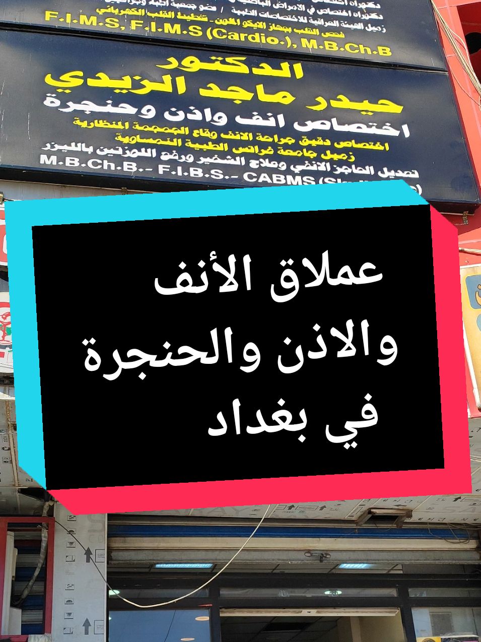 عملاق الأنف والاذن والحنجرة في بغداد  #doctor #medicina #medicine #nose #ear #larynx #trinding #explore #طب #انف #الاذن #الحنجرة #علاج #العراق #بغداد #ترند #اكسبلور #مدينةالصدر #جهاد_الزيدي 