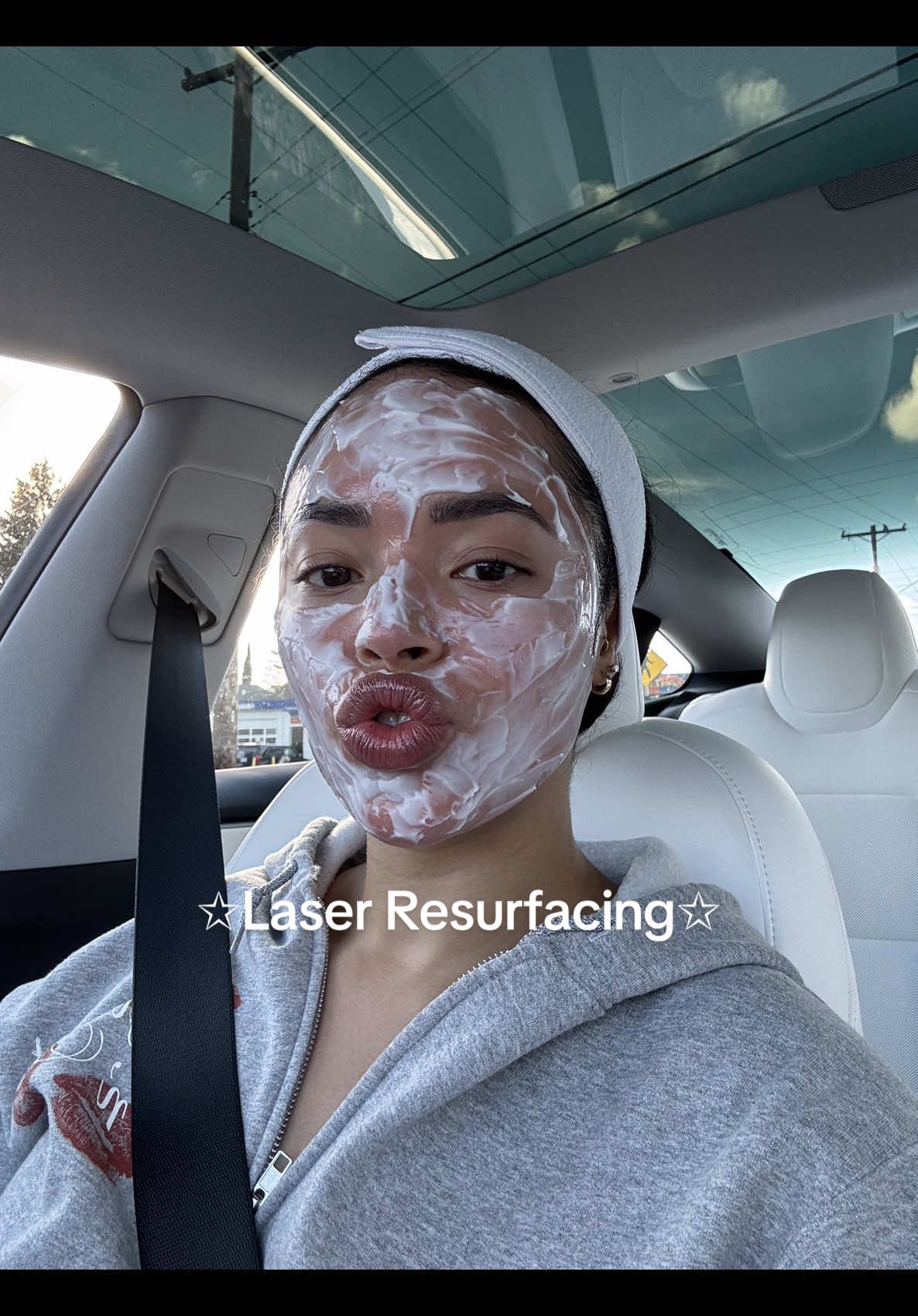 I did non ablative laser resurfacing! Which basically means it bypasses the top layers of the skin and penetrates straight down into the dermis. My goal was to get a collagen boost, improve texture/tone, and treat hyperpigmentation which starts in the basal layer 😊 its been a HOT min since I’ve gotten a treatment done.  I will be sharing healing process next! 🤍 #acne #acnejourney🥺 #acnescars #acneroutineskincare 