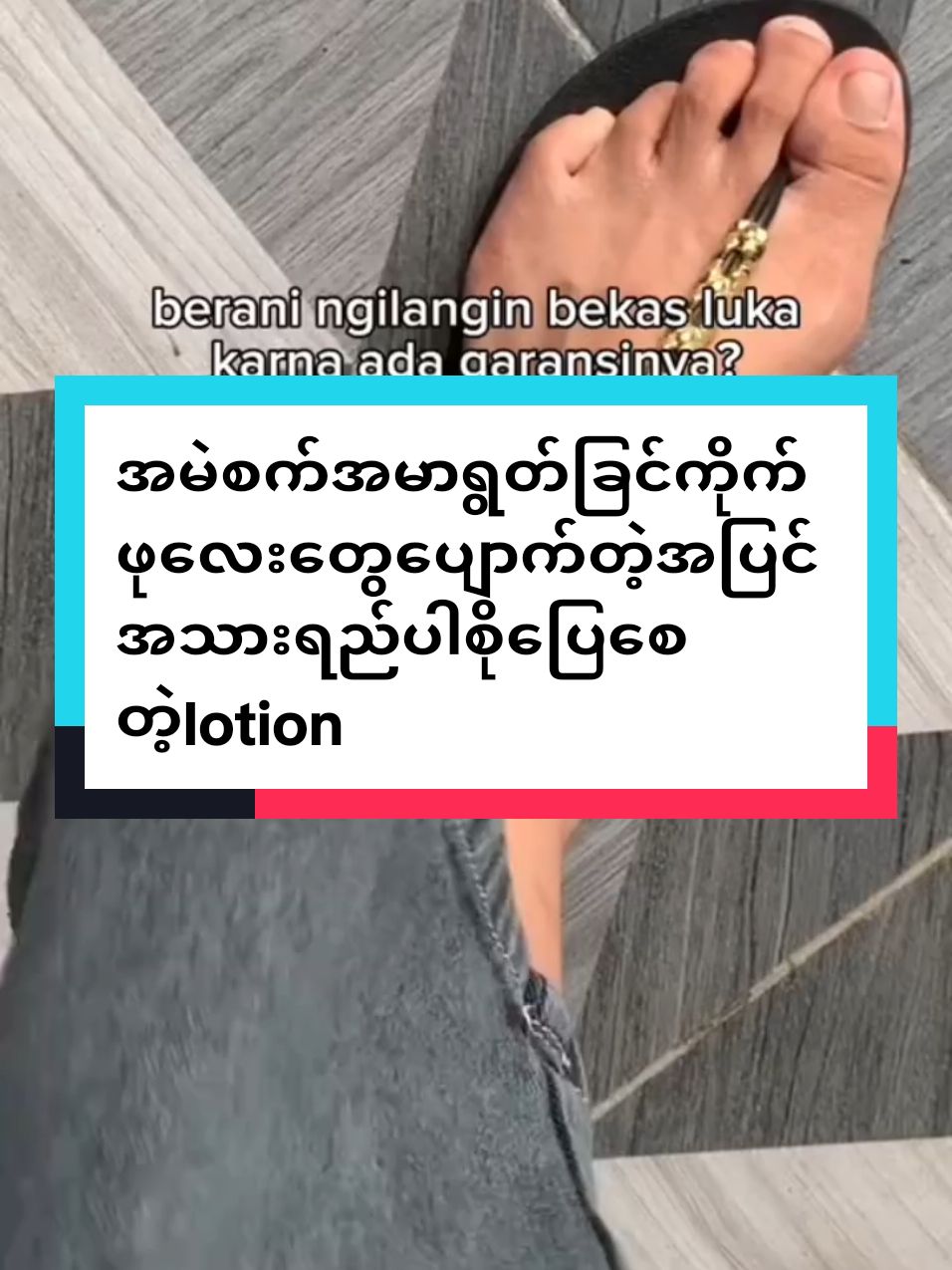 #ရေဓာတ်ဖြည့်lotion #ခြင်ကိုက်အမာရွတ်ပျောက်ချင်သူများ👀👀👀 #tiktok #myanmartiktok🇲🇲🇲🇲 #2025 #09259001890viberကနေအသေးစိတ်မေးပါ 