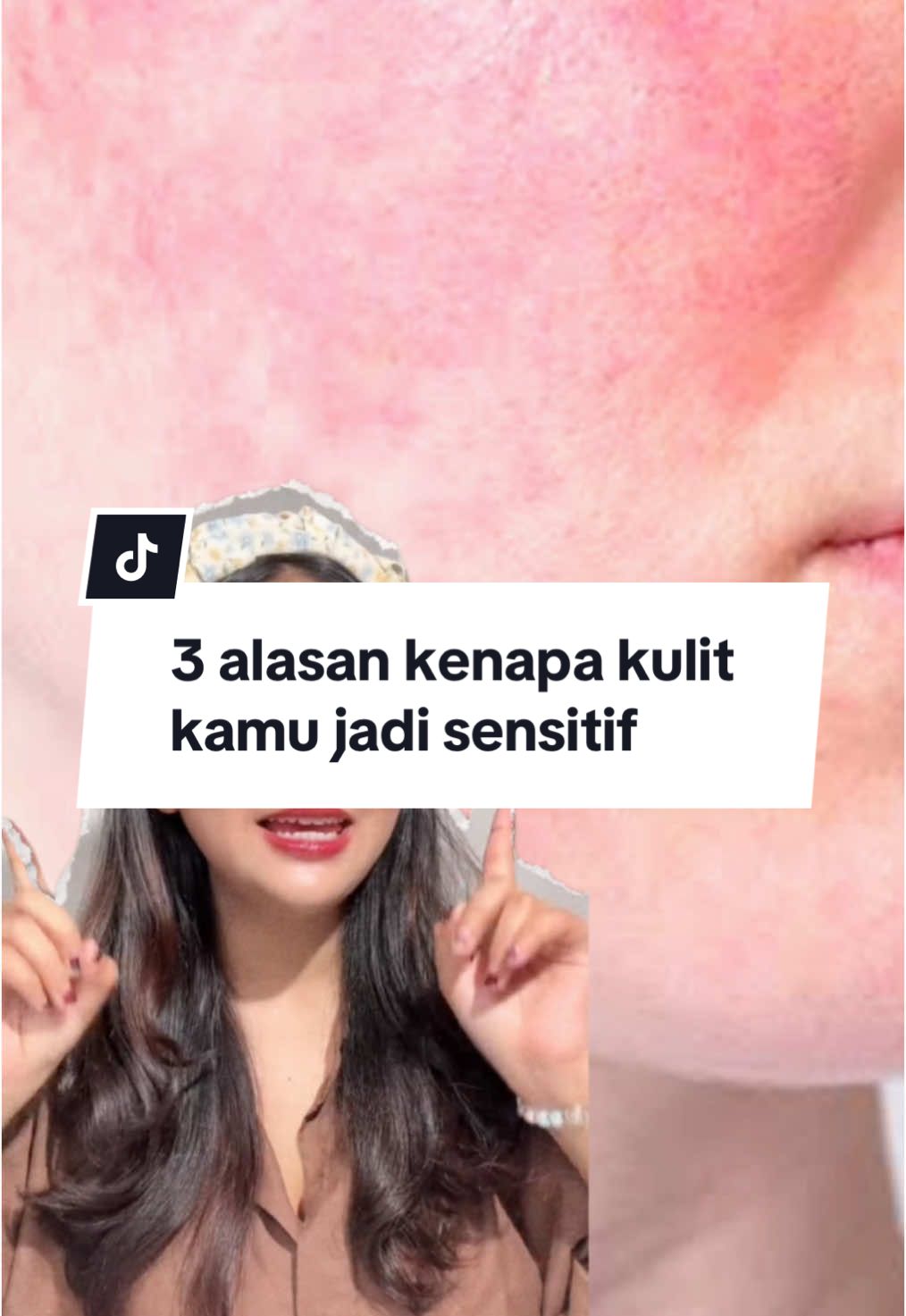 3 alasan kenapa kulit kamu jadi sensitif! Penasaran? tonton sampai habis yaa 🥰 #DrRochelle #RochelleIndonesia #skincare #YouMatter #DrGlowing