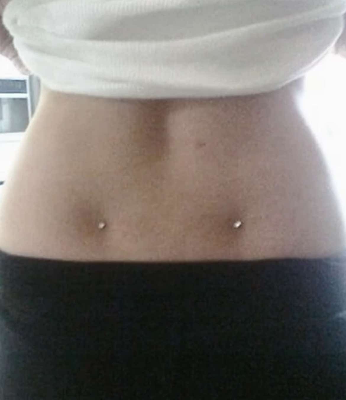 #backdermals 