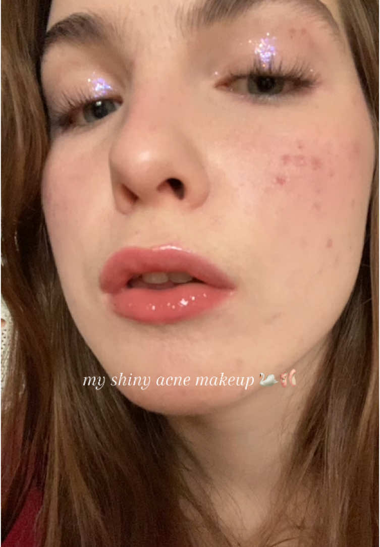 acne doesn’t make you less pretty, shine 🪽🫶🏻 #acne #acnemakeup #prettygirls  