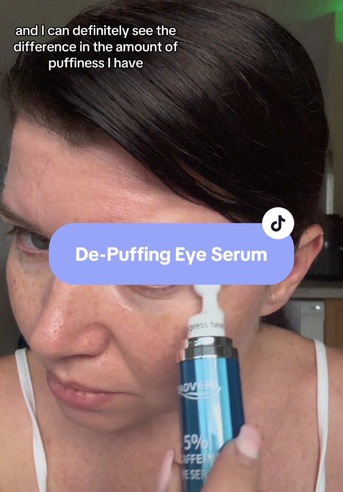 This eye serum is on sale with 46% off right now😃👍 #skin #skincare #skincareroutine #TikTokShop #skincaretips #facial #serum #eyeserum #undereyebags #eyeserum #skincare #skincareroutine #SkinCare101 #eyecream #hyaluronicacid #dongyueyeroller #hyaluronicacidserum ##vitaminc #creatorsearchinsights #NewYearNewAura #MoneySavingTips #TikTokBusinessCampaign @Tibobo Official 