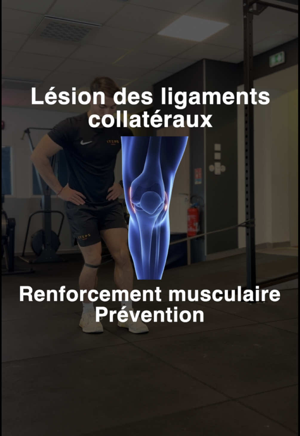 Ligaments collatéraux: prévention et renforcement musculaire  #ligamentscroisés #lc #lca #lcp #periostite #ligamentscollateraux #ligamentcollateral #genou #shin #tibia #ankle #cheville #knee #toulouse #musculation #renforcementmusculaire #joyeuxnoel #castres 