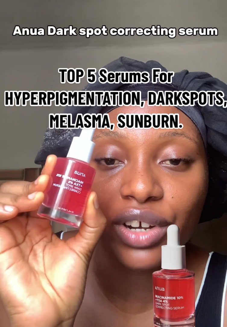 5 Serums for HYPERPIGMENTATION, DARKSPOTS, MELASMA.  #skincare #hyperpigmentation #darkspots #darkspottreatment  @nineless_official @anua_global @anua_influencers @Beauty of Joseon @Good Molecules @The Ordinary 