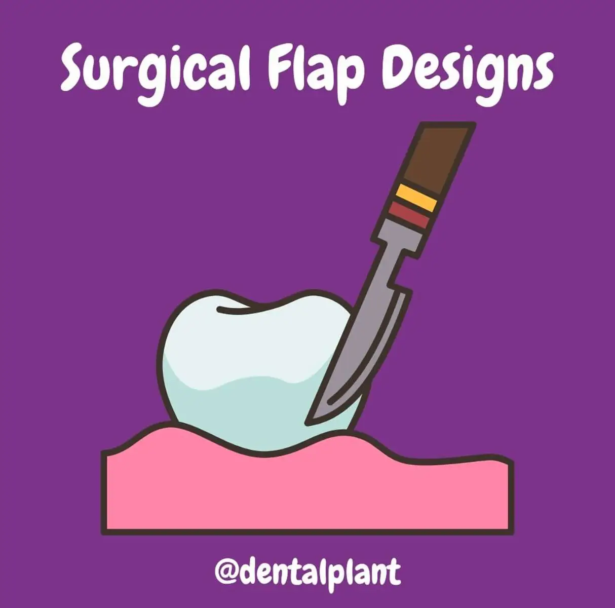 Surgical flap design in dentistry involves creating incisions to provide access to underlying tissues. Key principles include adequate size for visibility, preservation of blood supply, and prevention of tension 😬 Common designs include envelope, triangular, and trapezoidal flaps 💉 Proper design minimizes trauma, enhances healing, and ensures predictable outcomes in periodontal or surgical procedures 🔪 Credits: @dentalplant 🦷 Dental Student Success 🦷 📚 Ace Your Exams with Expert Questions 💡 Proven Tips & Techniques 🔗 DM for more info!!! #Dentistry #DentalCare #OralHealth #HealthySmile #SmileGoals #TeethWhitening #CosmeticDentistry #DentalHealth #toothexposure #SmileDesign #ToothCare #DentistLife #DentalTips #DentalEducation #DentalHygiene #DentalAssistant #DentalCommunity #DentalMarketing #DentalClinic #DentistryWorld #DentistTips #SmileMore #TeethTransformation #InvisalignJourney #BracesLife #SmileMakeover #PerfectSmile #DentalLove #SmileBright #toothgoals