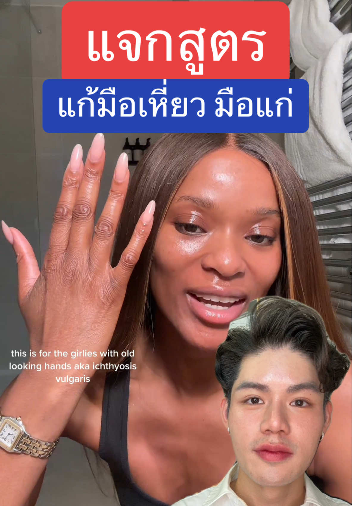 แจกสูตร แก้มือเหี่ยว มือแก่ ทำตามด่วน!! #พี่หนูปอนด์ #รวมสูตรผิวพี่หนูปอนด์ #noopondskin #รีวิวบิวตี้ #skinguru #retinol #tretrinoin #สกินแคร์ 