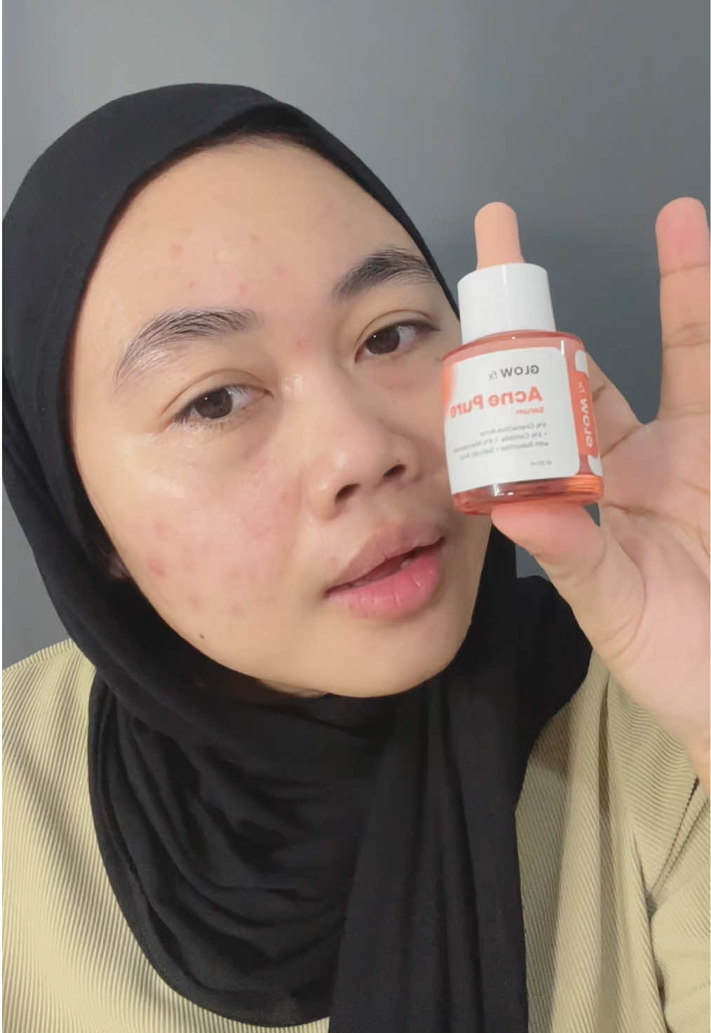 Serum utk kulit acne prone skin #glowfx #WIBGAJIAN #yearendsale #cuantanpabatas 