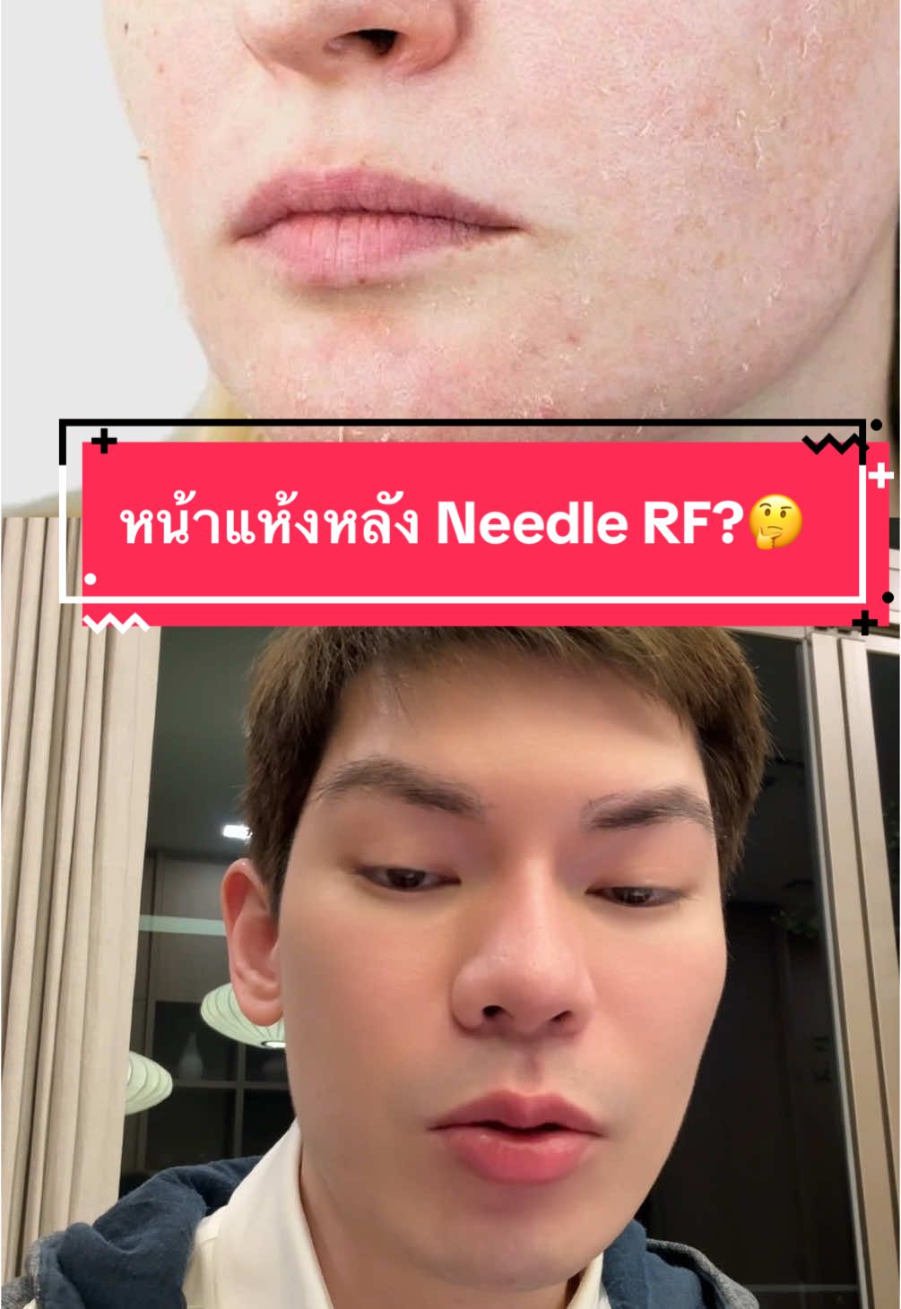 Replying to @น้องฟินนิช หน้าแห้งหลังทำ needle rf เพราะ?? #พี่กลางหอสมุดแห่งชาติ #drunkelephant #drunkelephantth