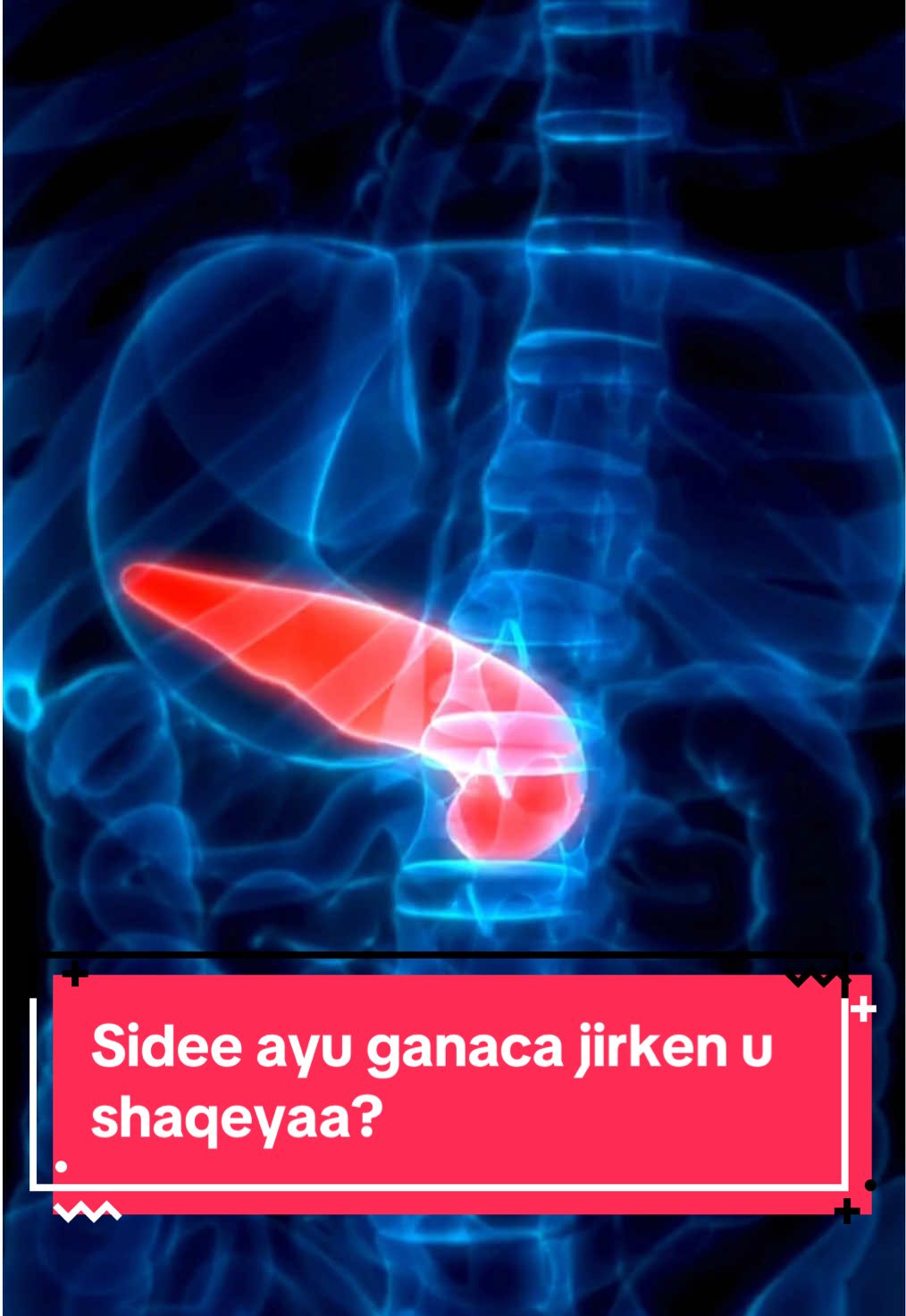 Maxaa keenay in jirkaaga sokorta ku badato? #somalitiktok #foroyou #DeeqDarajjo🚀 #Naftaadamaalgali✅ #usa_tiktoks #nairobitiktokers #somaligermany🇸🇴🇩🇪 #minnesota #canada_life🇨🇦 @TheLaughingLabcoat 