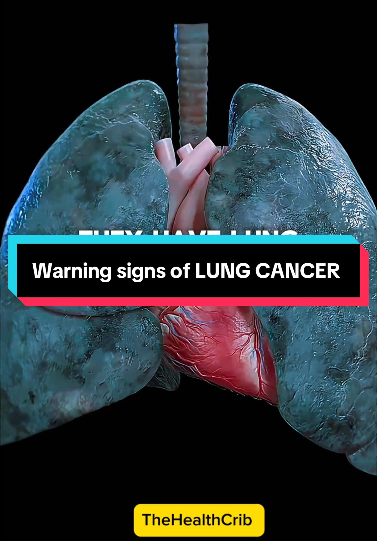 Warning signs of LUNG CANCER  #lungcancer#lungcancerawareness#lungcancersymptoms