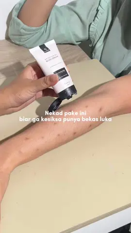 Cita-cita = menjadi glow up💋 #ingatbekaslukaingatdsavior #kulitkusam #bodyserum #kulitbelang #bekaskoreng #bekasluka 
