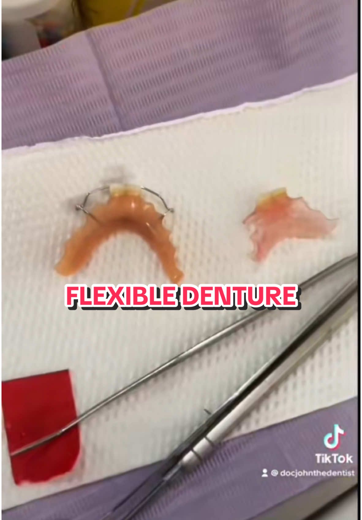 #onthisday FLEXIBLE DENTURES #docjohnthedentist 