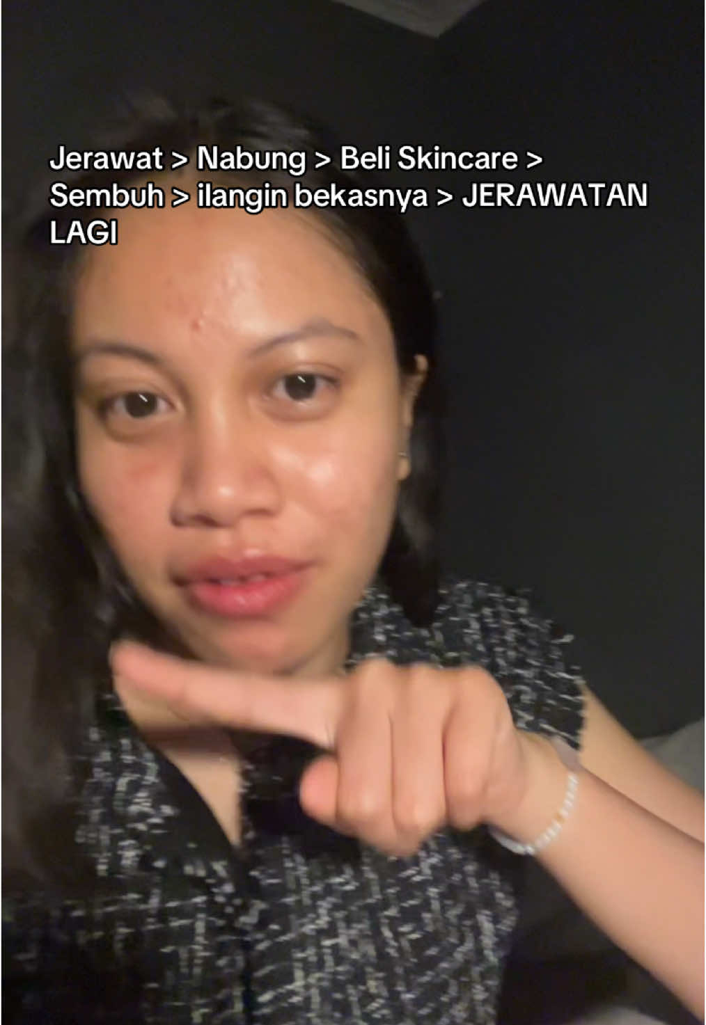 muter muter aja disitu🥹 #acnetreatment #acne #acnefighter #skincare #skin #jelajahkuliner 