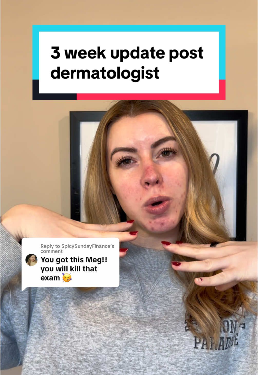 Replying to @SpicySundayFinance did anyone notice the t swift reference 👀 #cabtreo #winlevi #doxycycline #adultacne #acneinmy30s #dermatologist #chemicalengineer #financegirly 