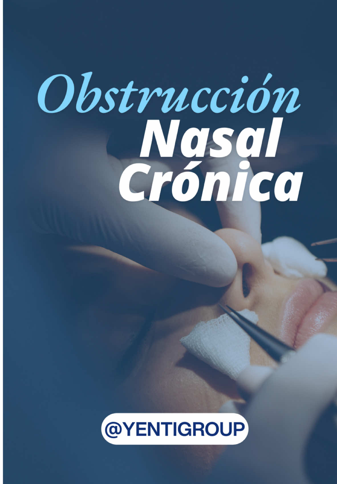 ¿Te cuesta respirar por la nariz todo el tiempo? 👃 #SaludRespiratoria #RespiraMejor #Sinusitis #Alergias #Bienestar