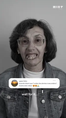 Realmente não muda NADA! 😱😁 #lisboa #dentista #sorrisoperfeito #sorrisolindo #clinicamint #smiledesign #smilemakeover #dentistry #dentist #smile #sorriso #aestheticdentistry #beforeafter #changes #mudar #tvi #viral