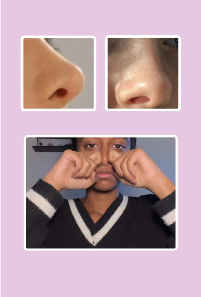 Smaller nose exercises  #nosejob #smallnose #noseexercise #nosejobathome #slimmernose #slimnose #fyp #goviral 